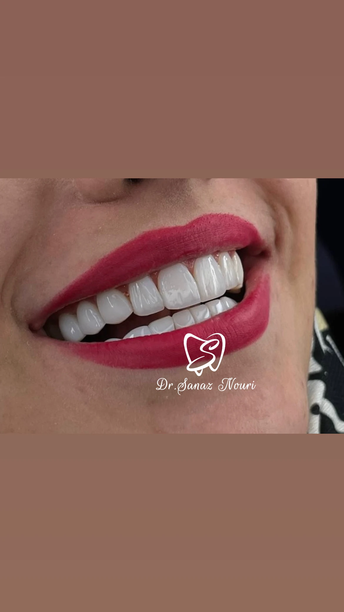 مطب دندانپزشکی دکتر ساناز نوری - دندانپزشک در تهران - تصویر 2