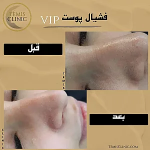 مطب پوست و مو زیبایی و لیزر تمیس