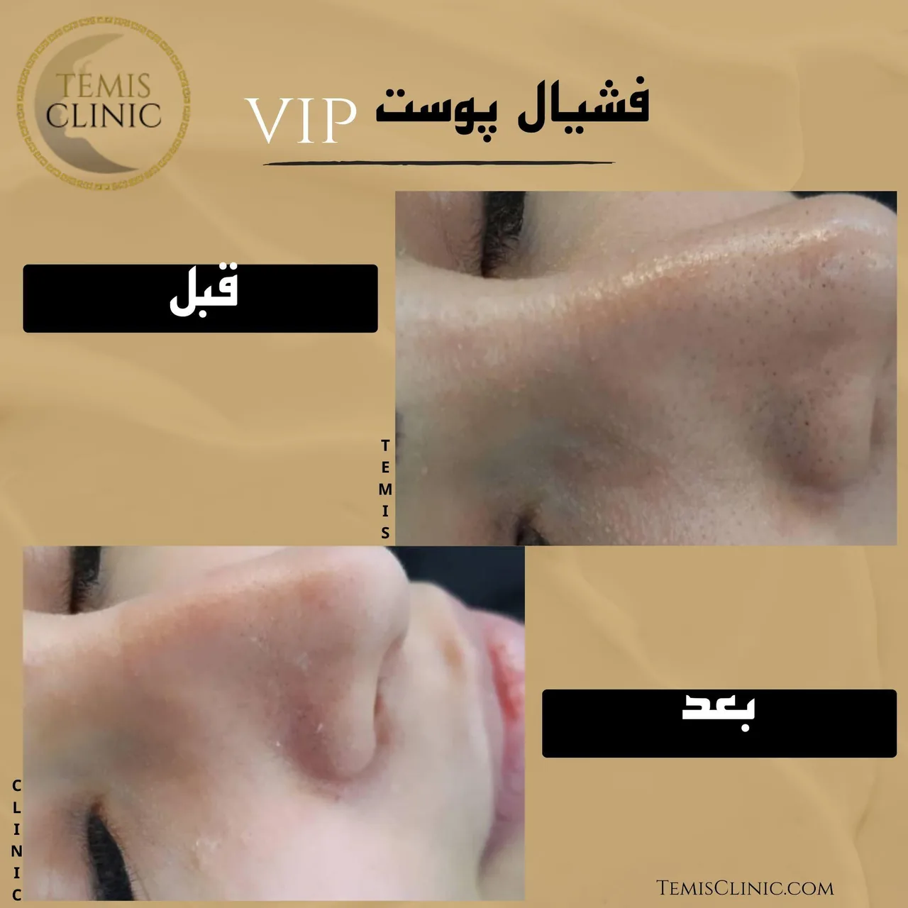 مطب پوست و مو زیبایی و لیزر تمیس
