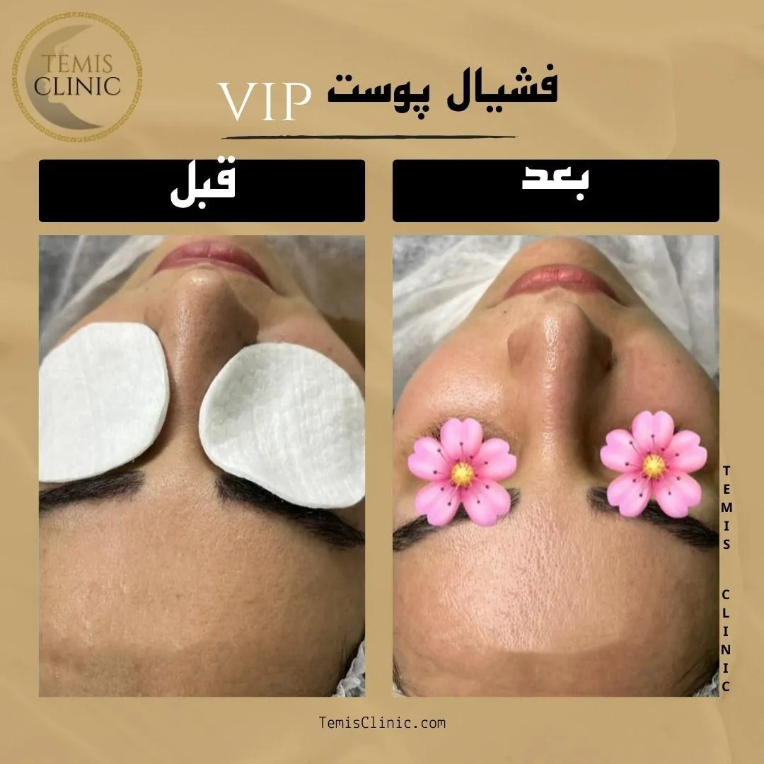 مطب پوست و مو زیبایی و لیزر تمیس - تصویر 2