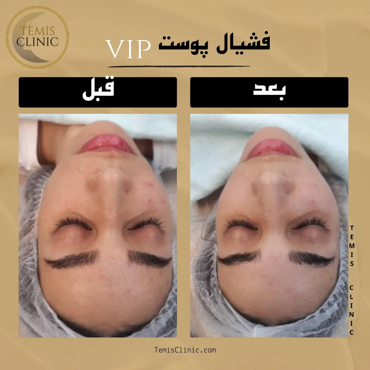 مطب پوست و مو زیبایی و لیزر تمیس - تصویر 3