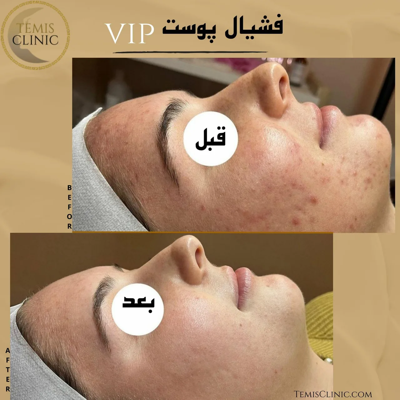 مطب پوست و مو زیبایی و لیزر تمیس - تصویر 4