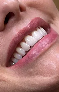 دندانپزشک و زیبایی پوست دکتر اَمَن زاده