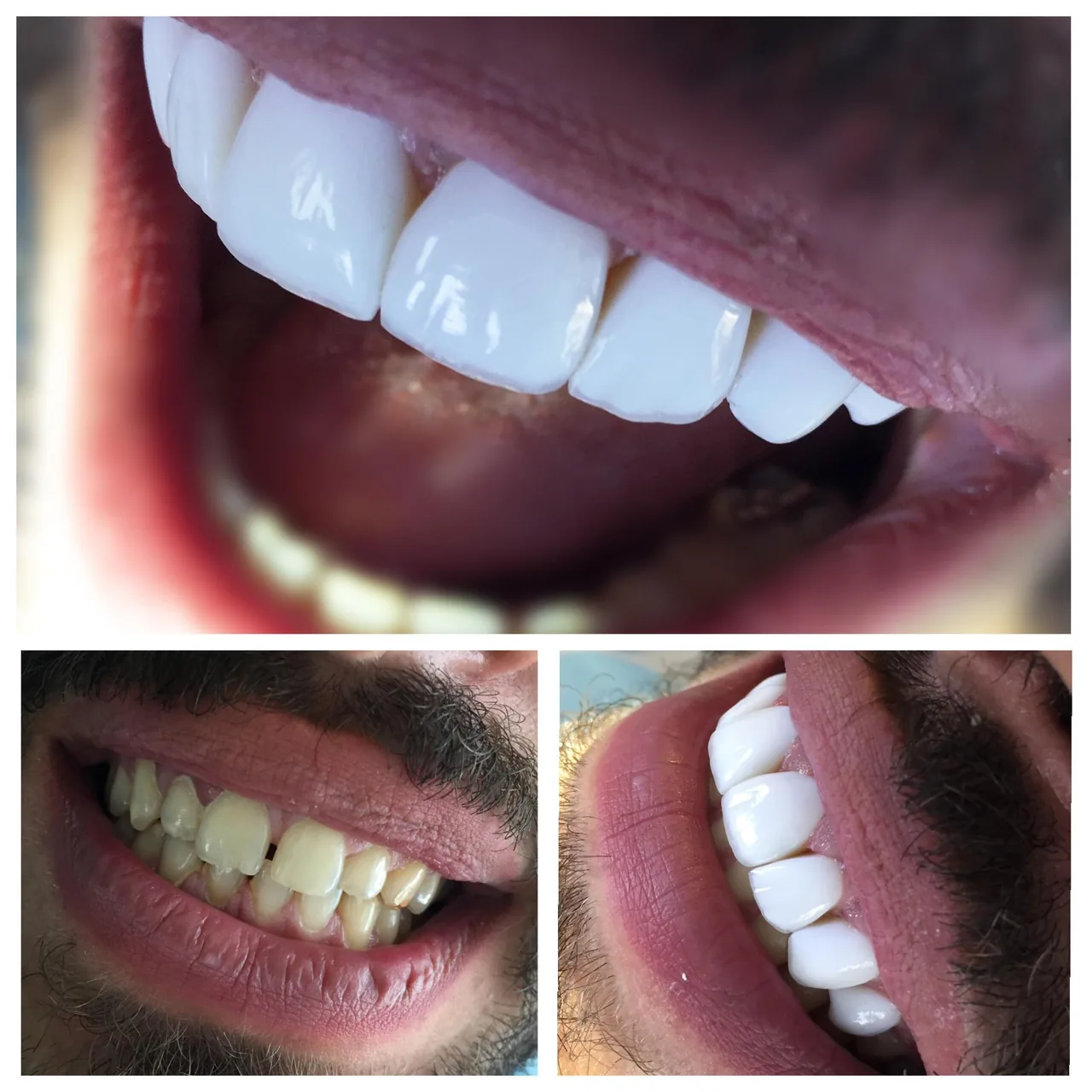دندانپزشکی و دندانسازی نکو - تصویر 2