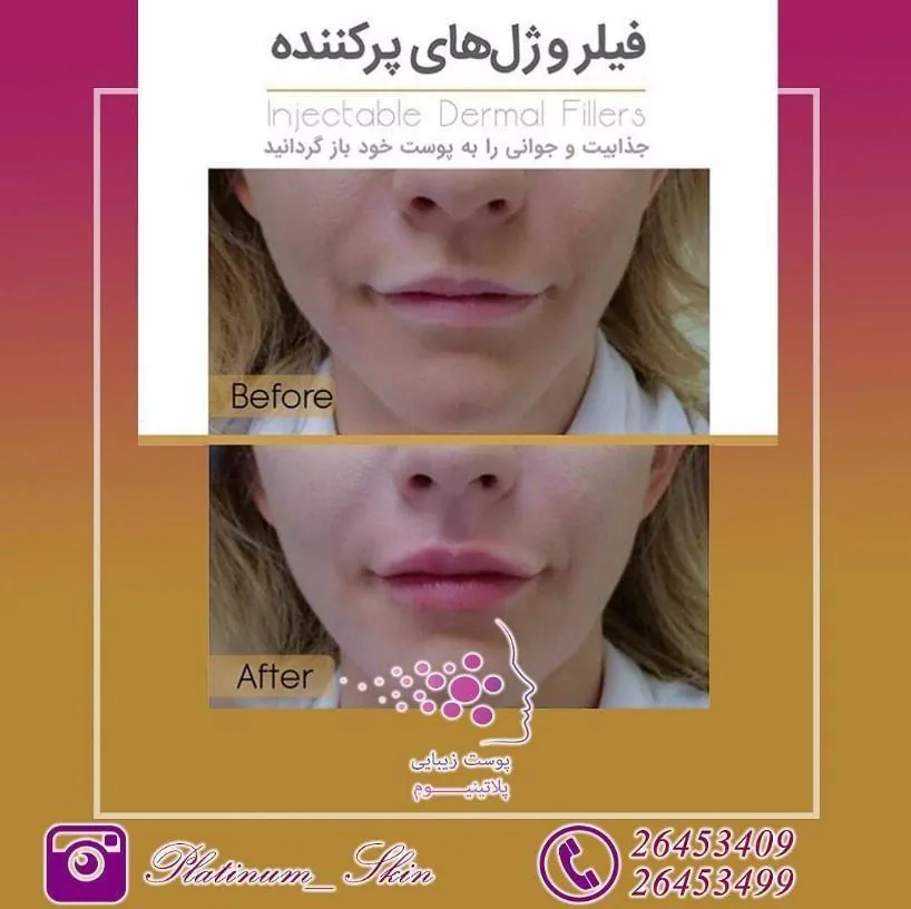 مرکز پوست و لیزر موهای زائد پلاتینیوم - تصویر 2