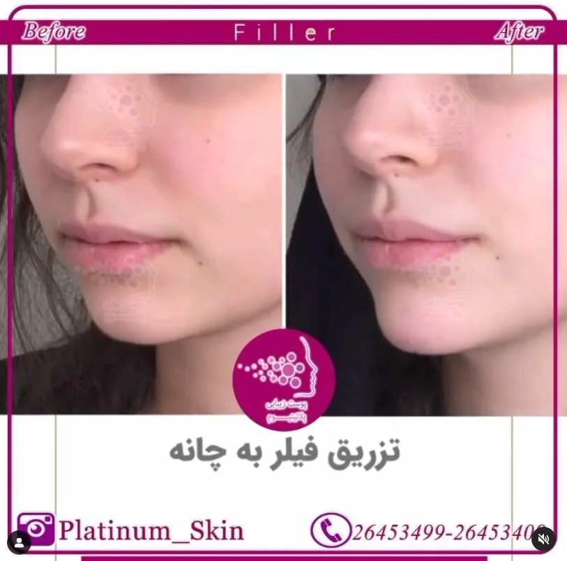 مرکز پوست و لیزر موهای زائد پلاتینیوم - تصویر 3
