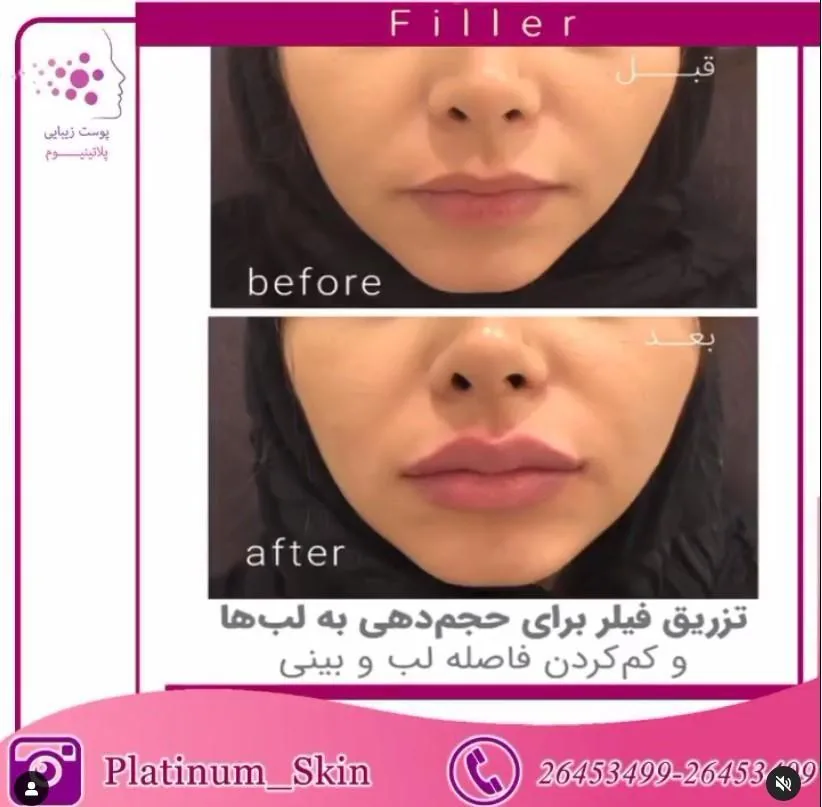 مرکز پوست و لیزر موهای زائد پلاتینیوم - تصویر 4