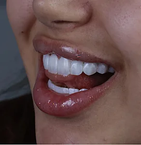 مطب دندانپزشکی دکتر بهاره علیزاده