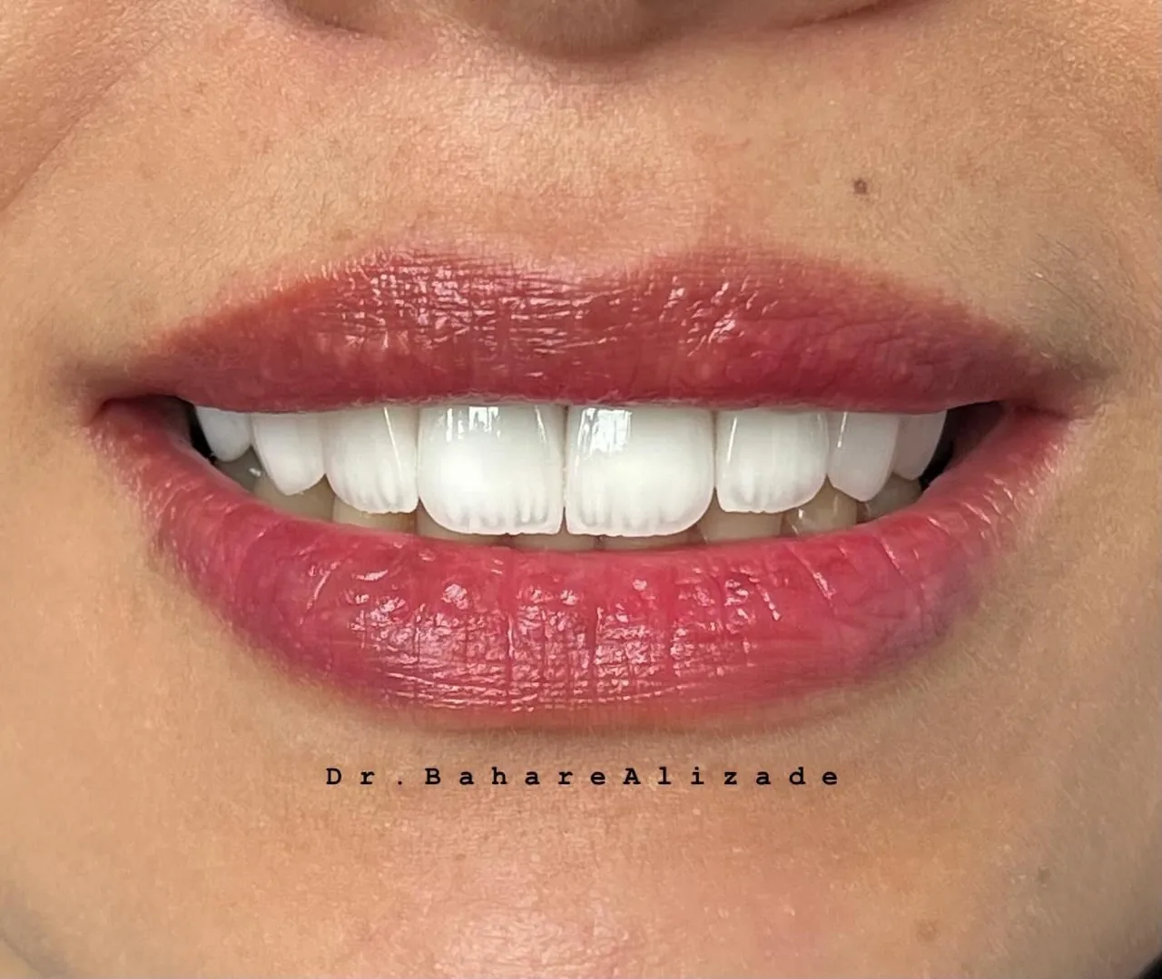 مطب دندانپزشکی دکتر بهاره علیزاده - تصویر 4