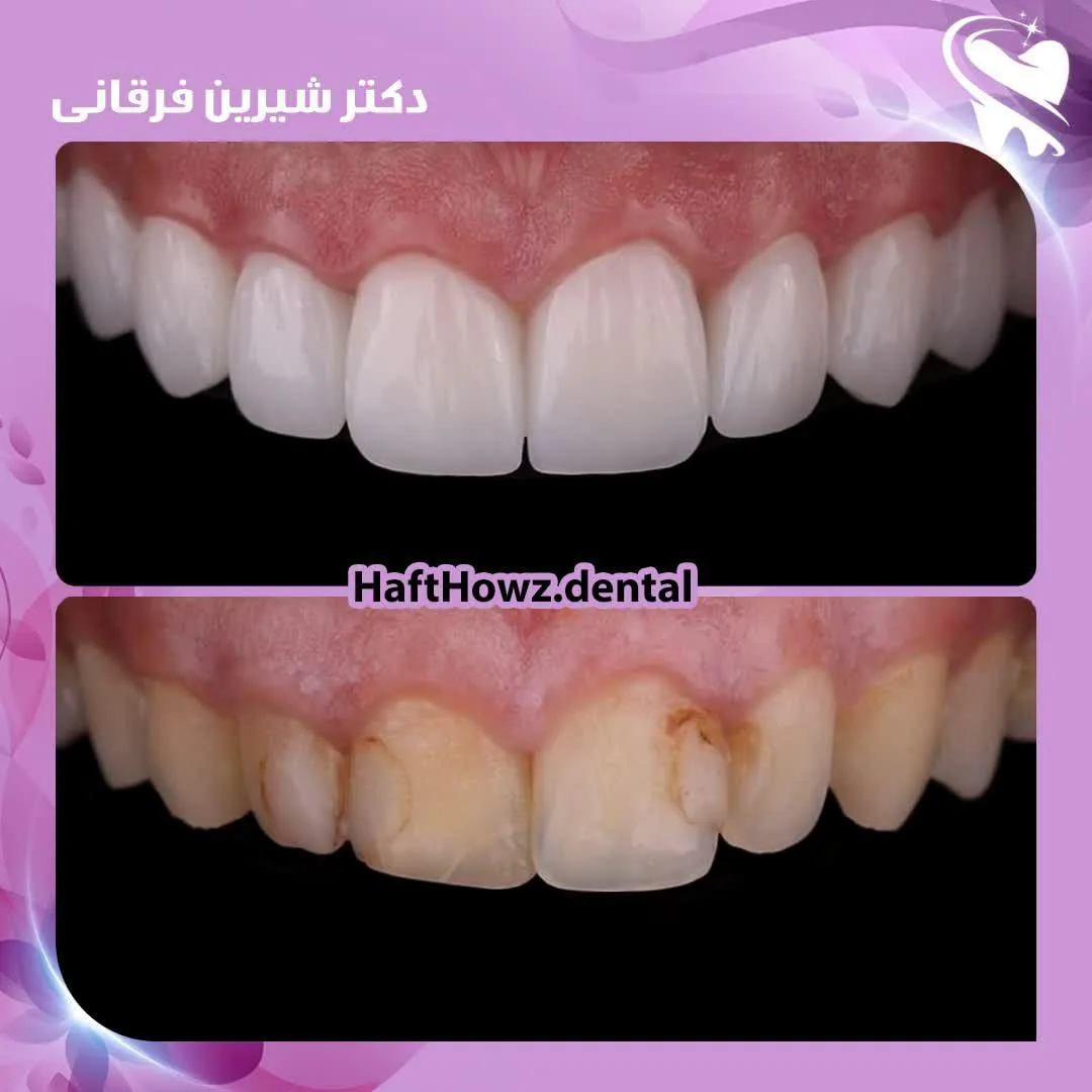 دندانپزشکی هفت حوض - تصویر 4