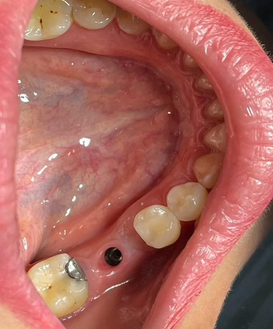 کلینیک دندانپزشکی کامکار [] Kamkar Dental - تصویر 4