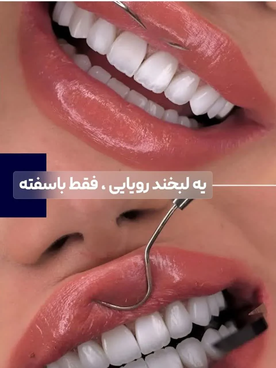 کنزودنت - تصویر 3