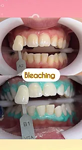 دندانپزشکى کودکان و‌بزرگسالان دکتردیبائی
