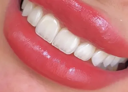 کلینیک دندانپزشکی تهرانسر