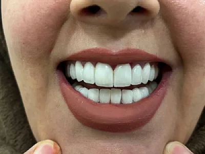 دندانپزشکی و زیبایی جردندنتال