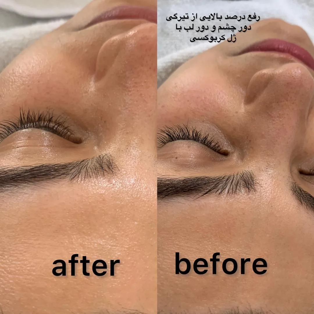 آکادمی  پوست و تناسب اندام ترمه(20% تخفیف) - تصویر 2