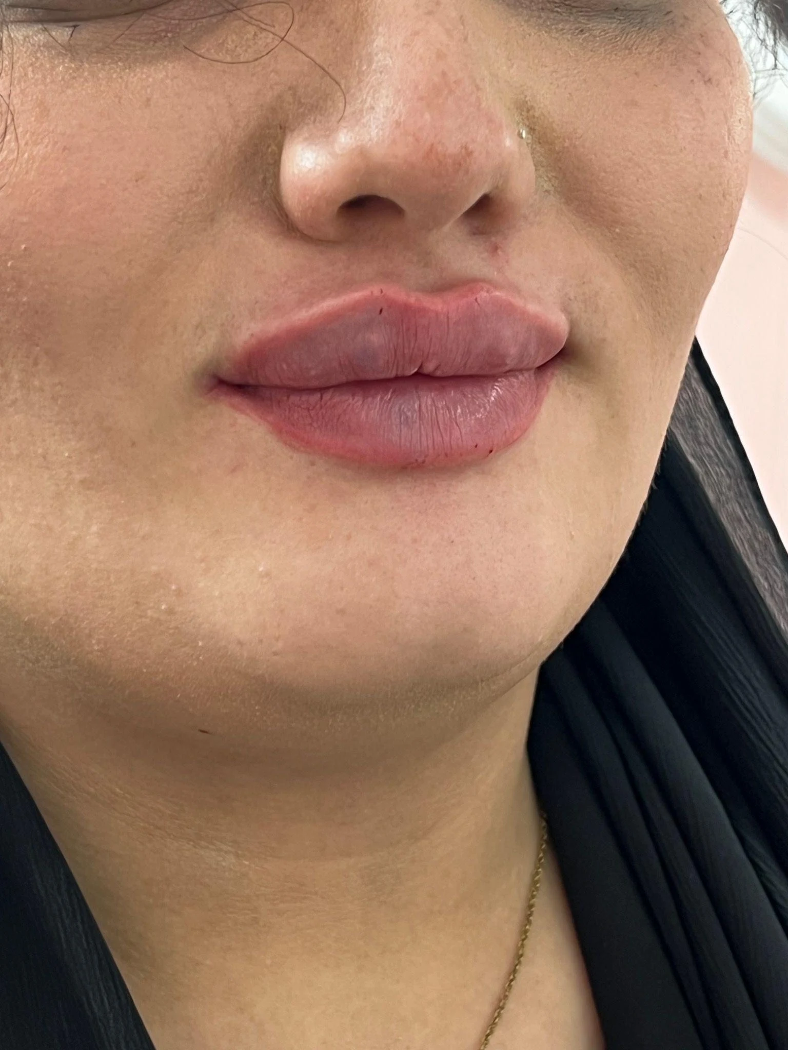 کلینیک زیبایی و لیزر آیسان