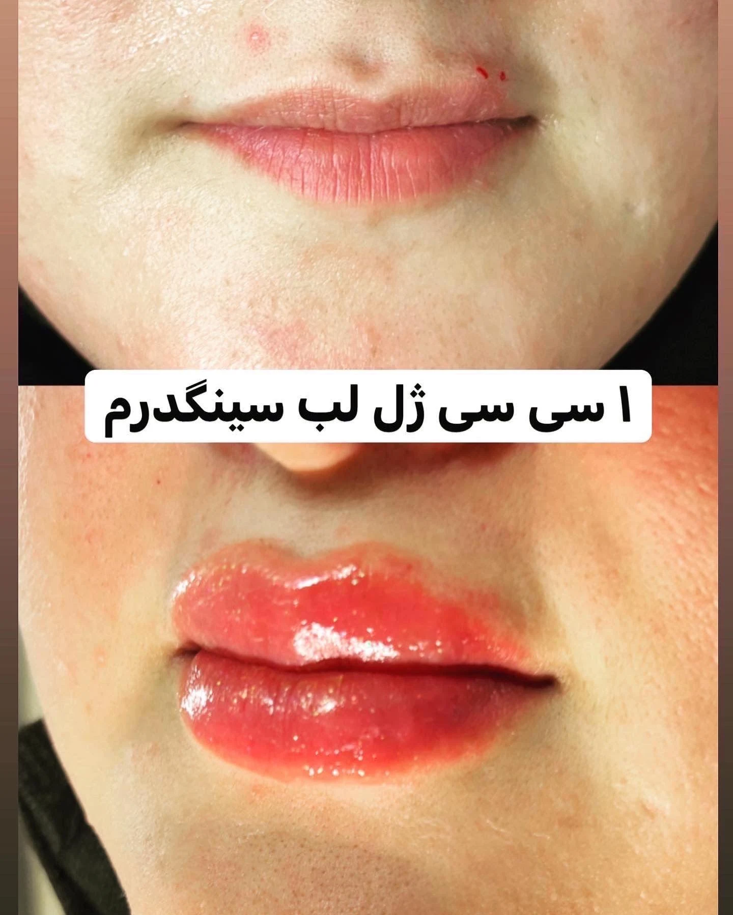 کلینیک زیبایی و لیزر آیسان - کلینیک پوست و زیبایی در تهران - تصویر 4