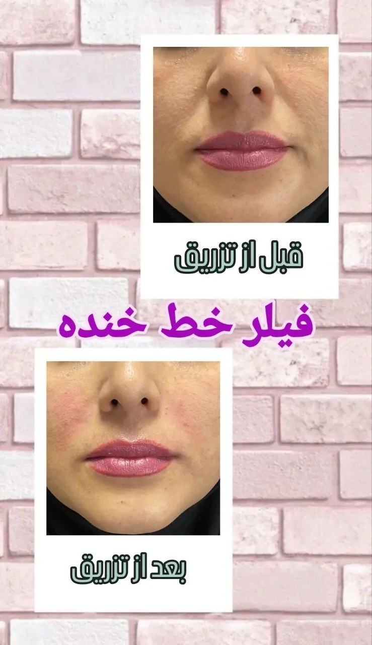 کلینیک زیبایی و لیزر گل ارکیده - تصویر 2