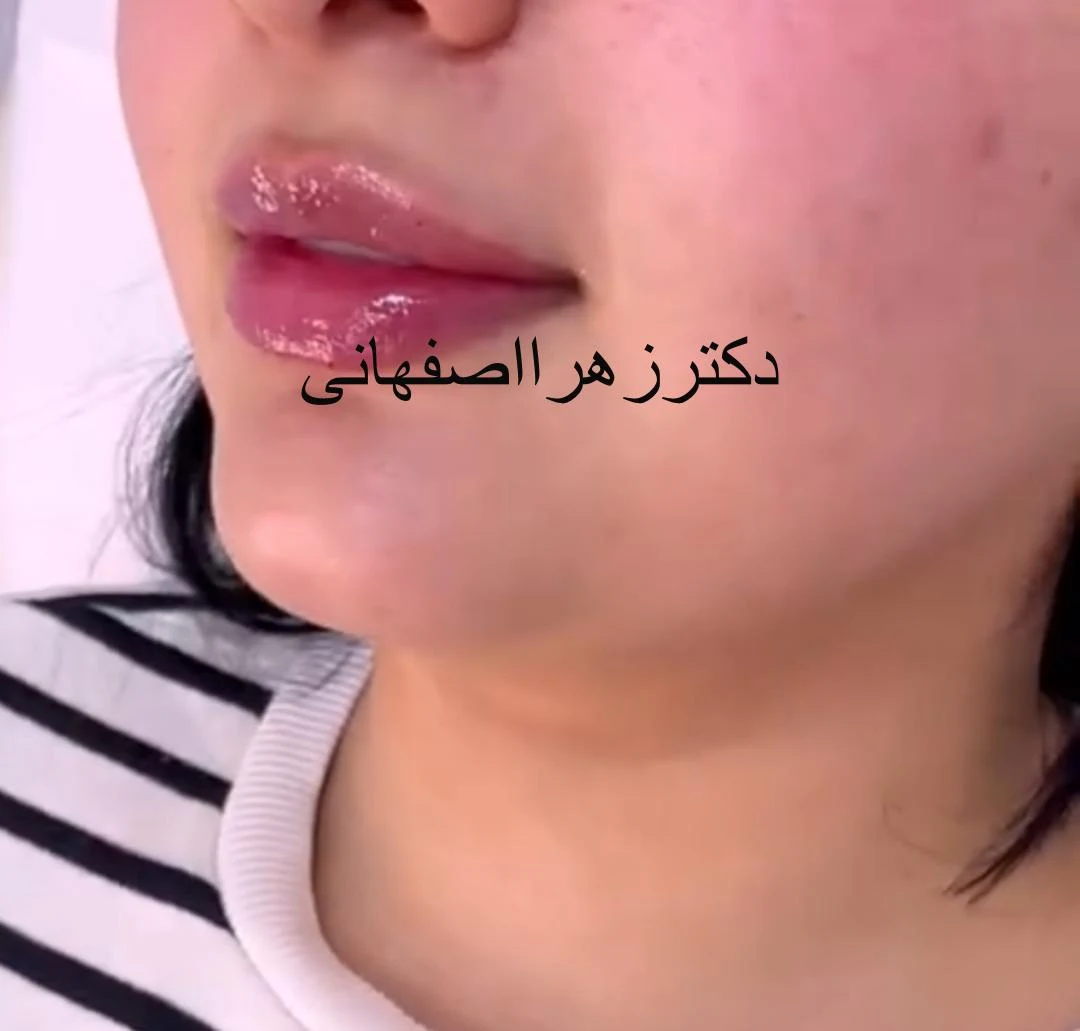 مرکز لیزر و کلینیک زیبایی ونوس - تصویر 2