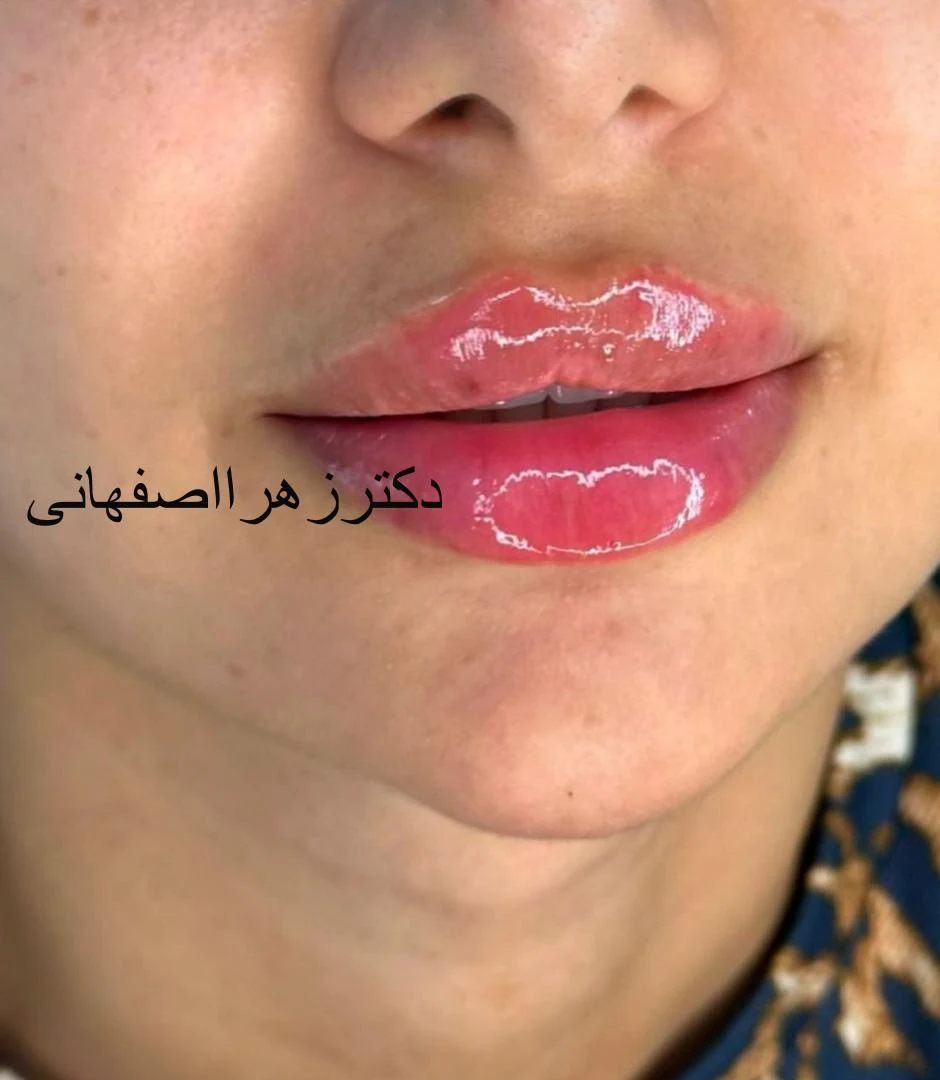 مرکز لیزر و کلینیک زیبایی ونوس - تصویر 4