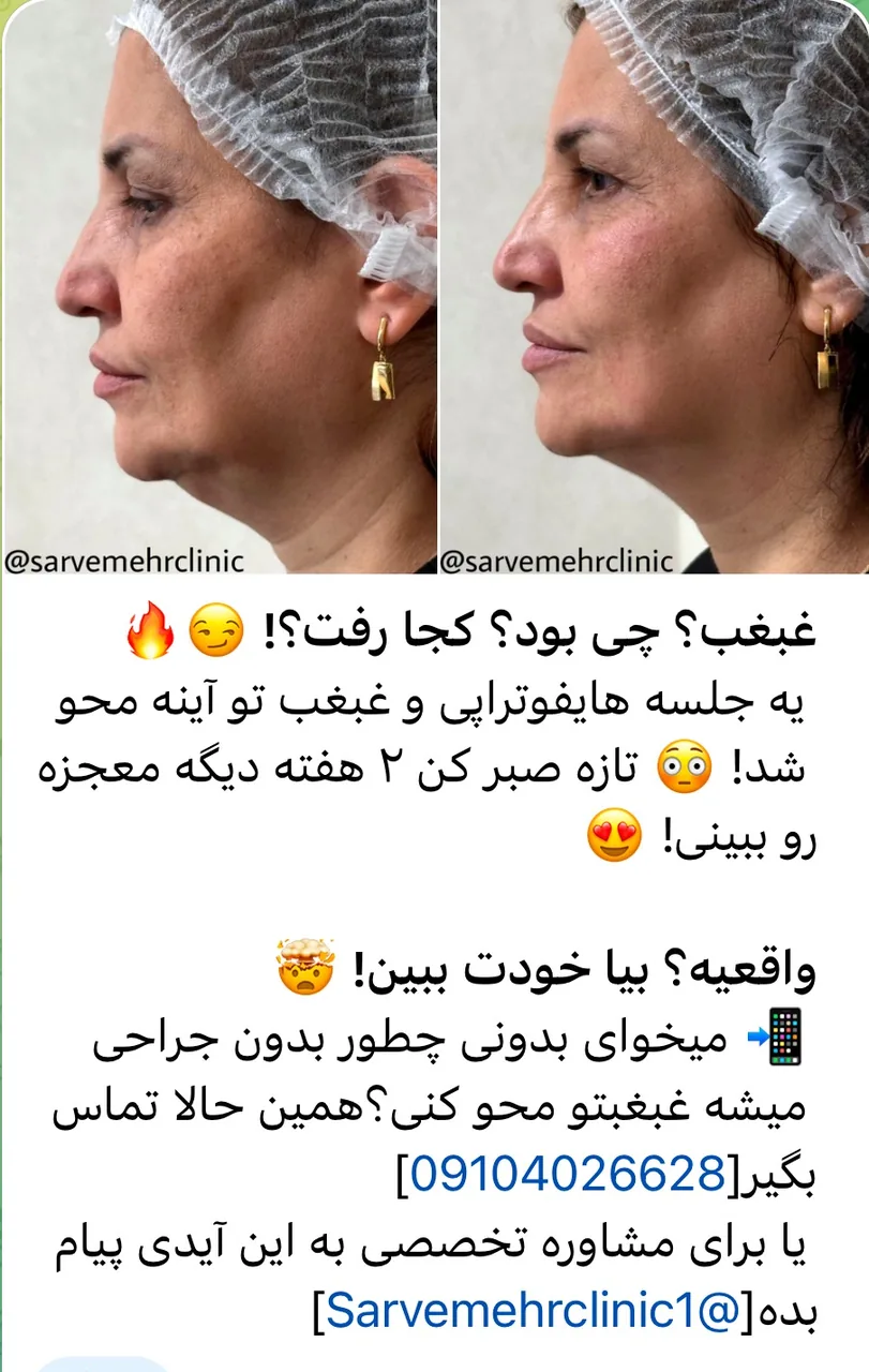 مرکز لیزر،پوست،مو و زیبایی سرو مهر - تصویر 2