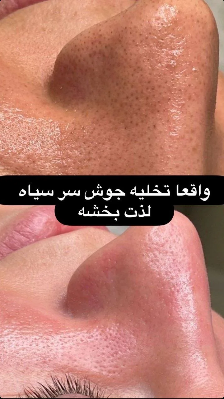 مرکز لیزر،پوست،مو و زیبایی سرو مهر - تصویر 3