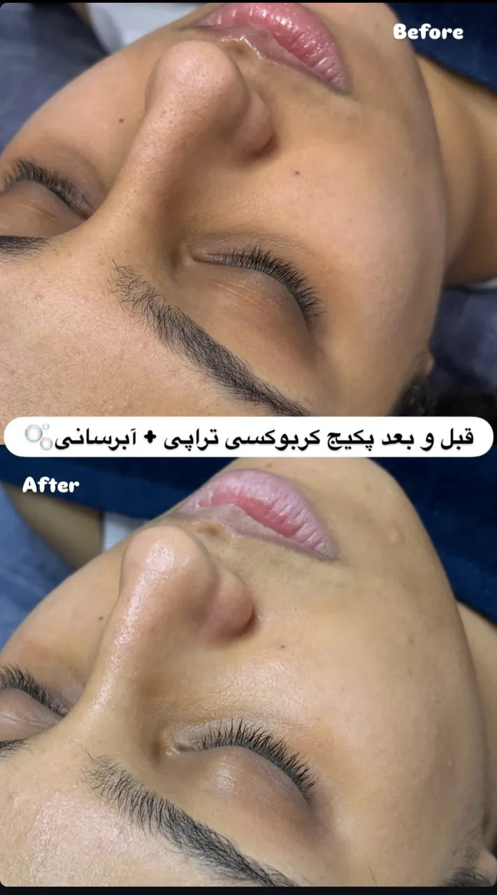 مژگان اسکین کرMojgan skincare - تصویر 3