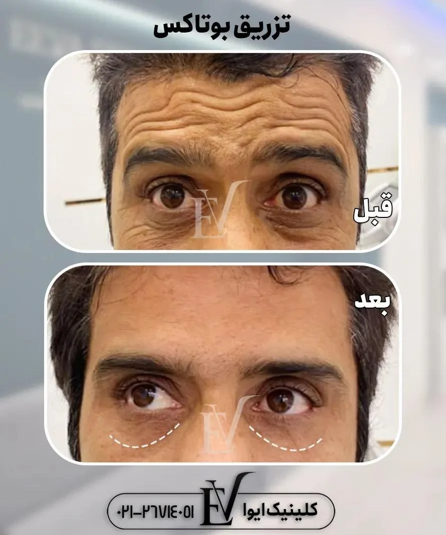 کلینیک تخصصی پوست مو زیبایی ایوا - تصویر 2