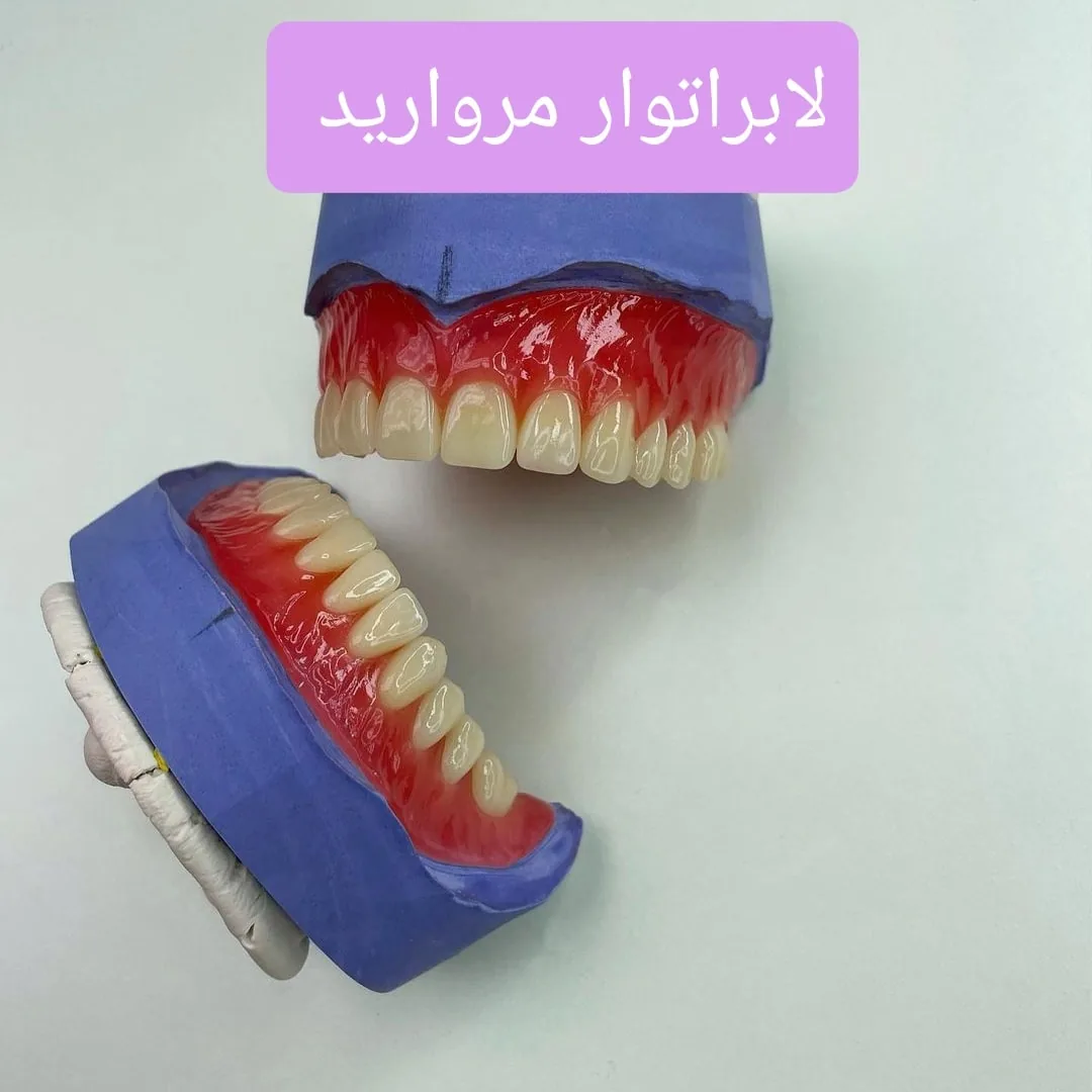 دندانسازی متحرک نگین - تصویر 4