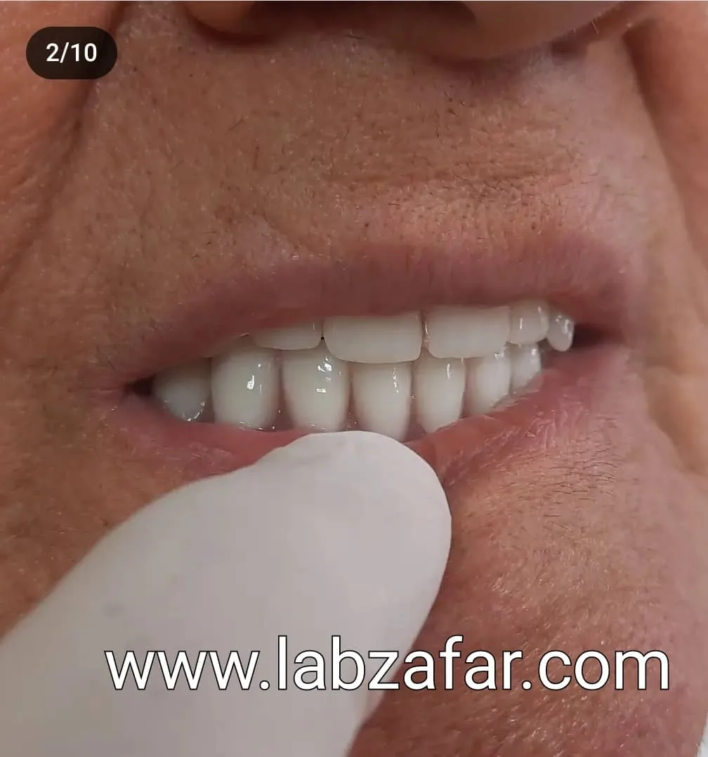 دندانسازی ظفر - تصویر 2