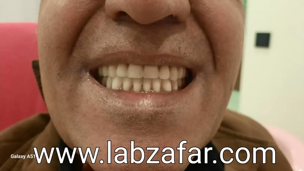 دندانسازی ظفر - تصویر 4