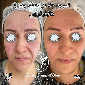 کلینیک تخصصی ستاره الماس زیبایی