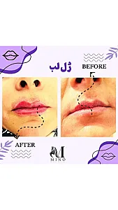 مجموعه زیبایی مینو