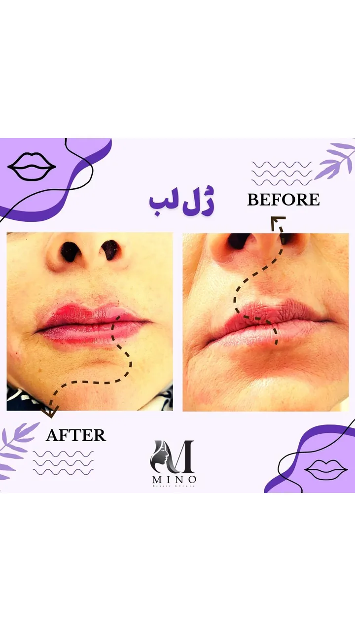 مجموعه زیبایی مینو