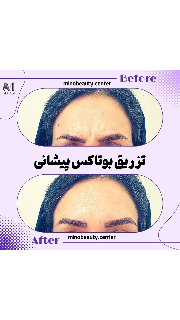 مجموعه زیبایی مینو - تصویر 2