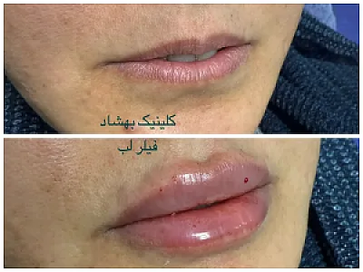 کلینیک تخصصی پوست و زیبایی بهشاد