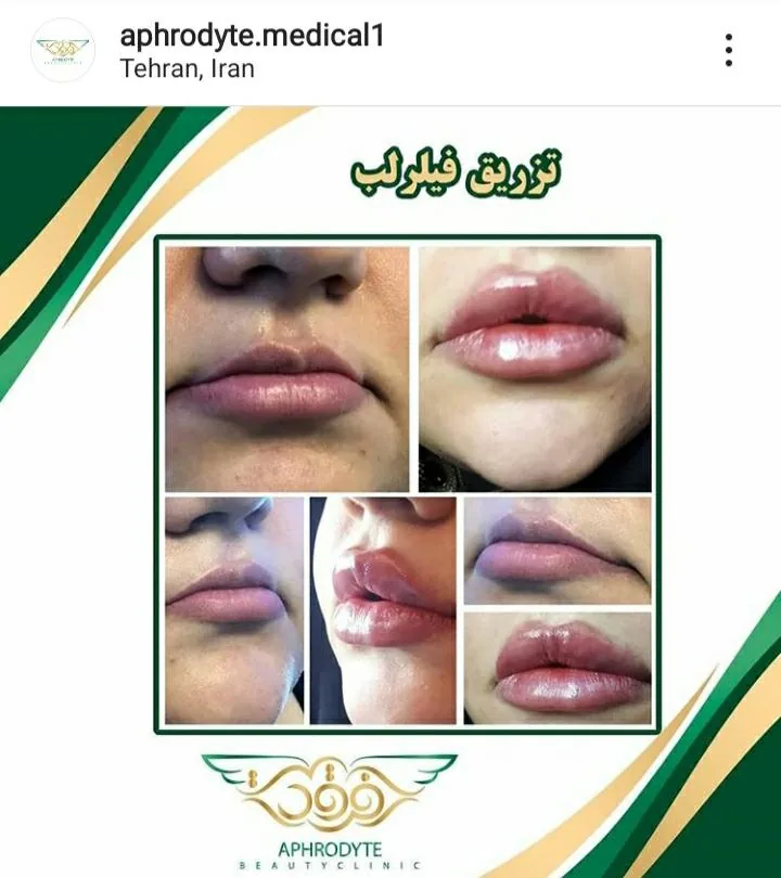 مطب پوست و مو آفرودایت - تصویر 2