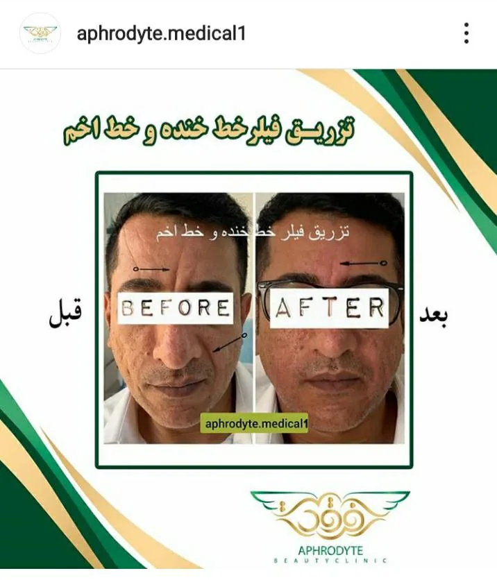 مطب پوست و مو آفرودایت - تصویر 3