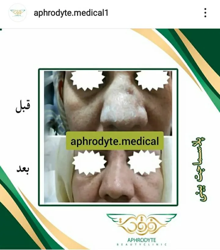 مطب پوست و مو آفرودایت - تصویر 4