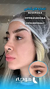 کلینیک زیبایی موچه