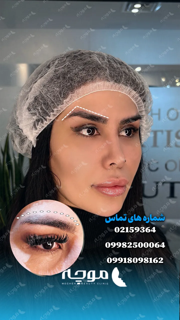 کلینیک زیبایی موچه - تصویر 2
