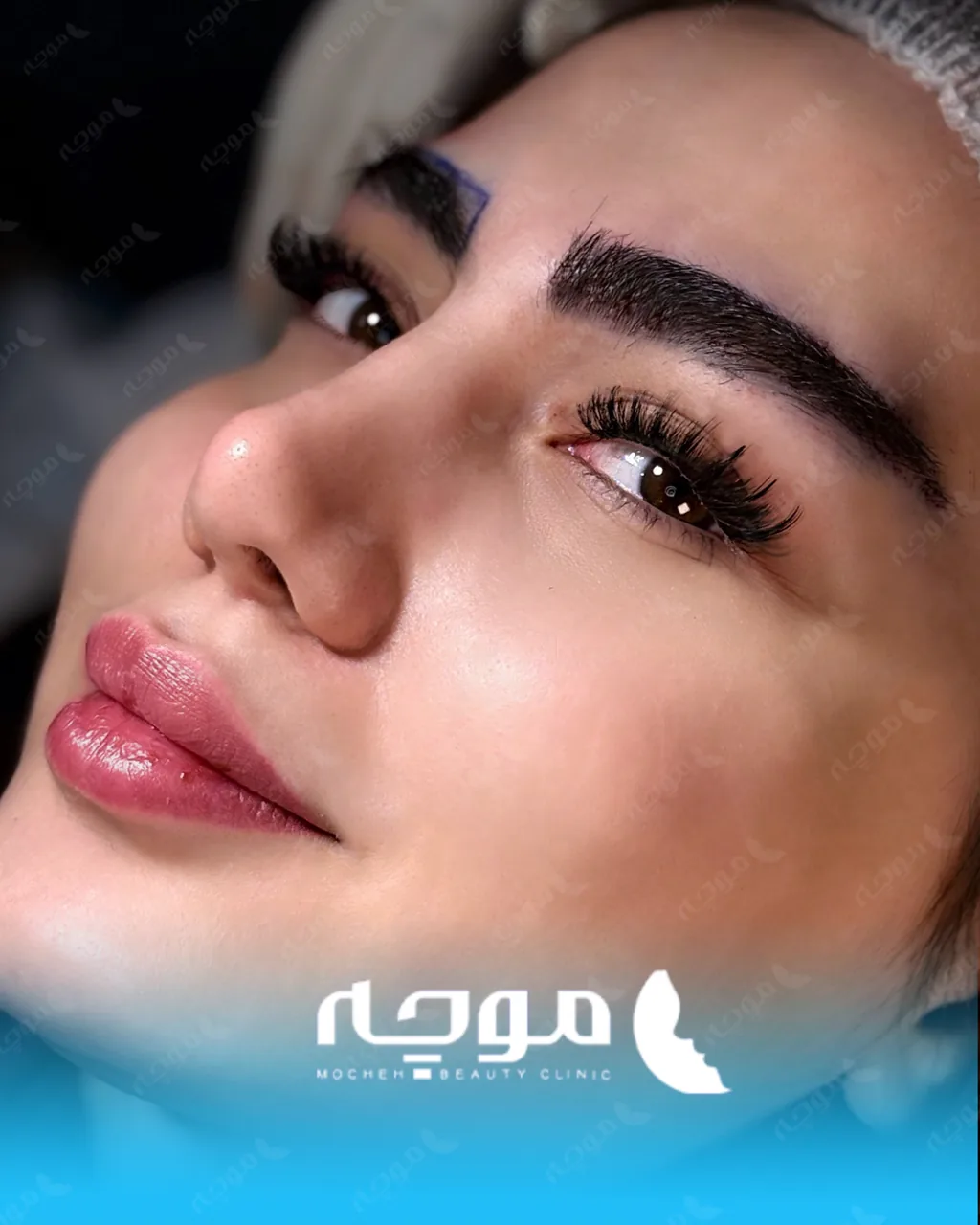 کلینیک زیبایی موچه - تصویر 3