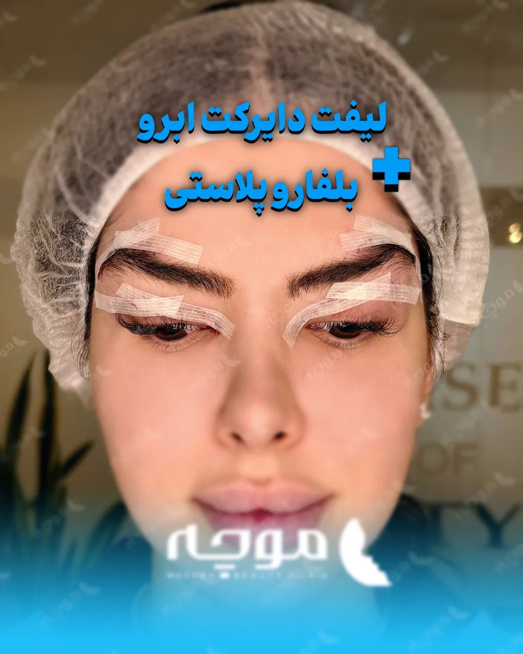 کلینیک زیبایی موچه - تصویر 4