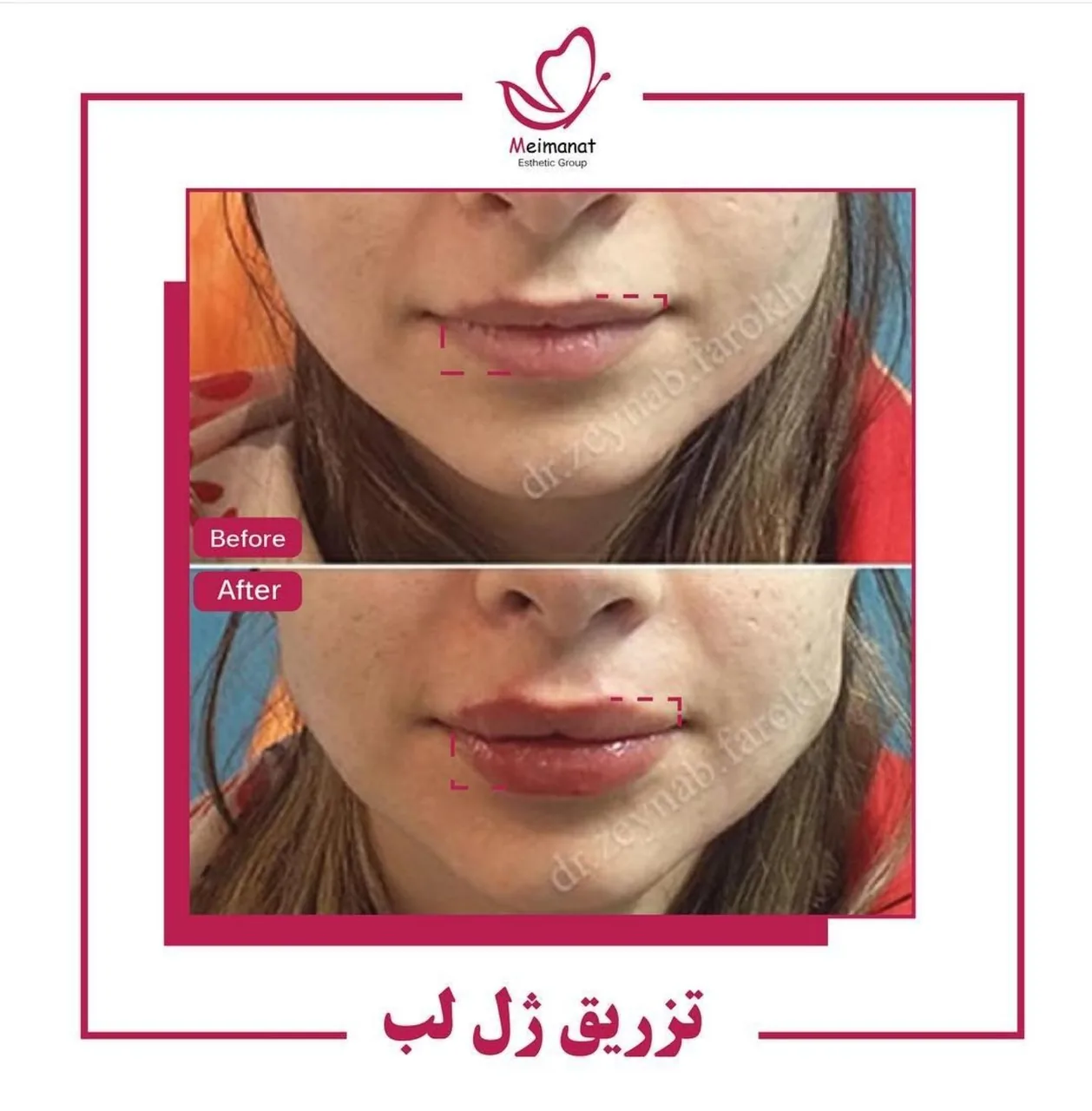 کلینیک پوست و زیبایی دکتر مهدی میمنت