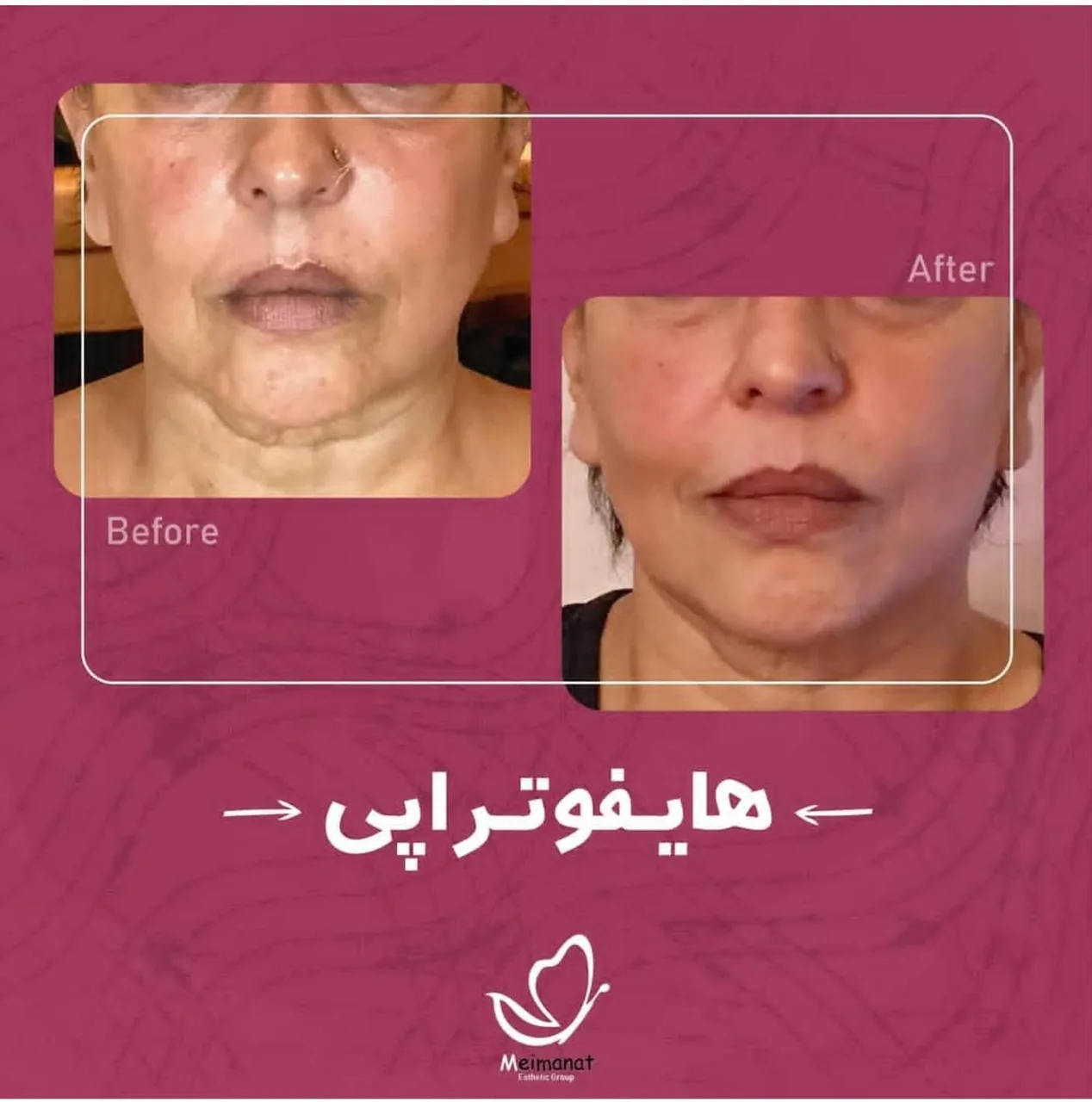 کلینیک پوست و زیبایی دکتر مهدی میمنت - تصویر 2
