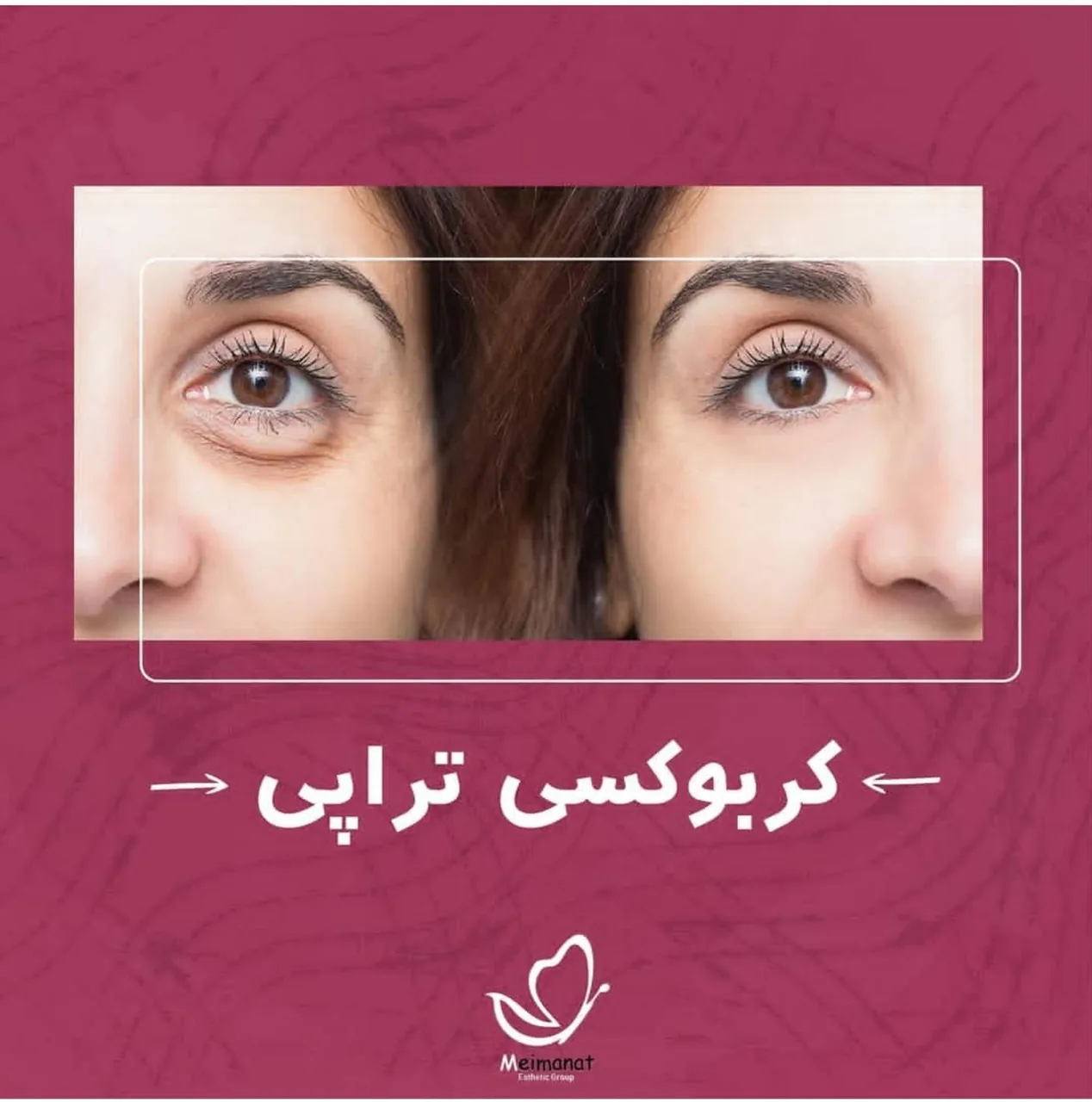 کلینیک پوست و زیبایی دکتر مهدی میمنت - تصویر 4