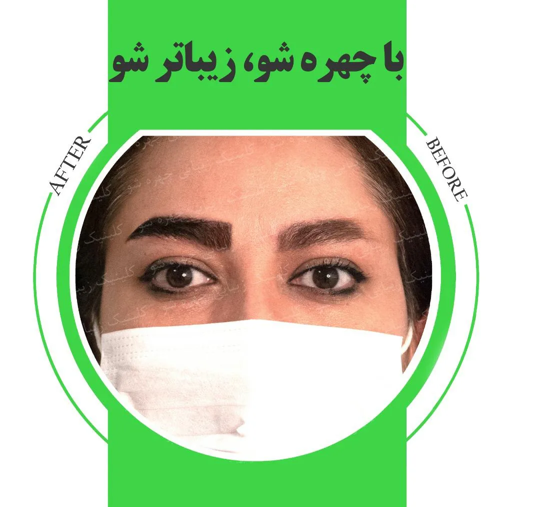 کلینیک زیبایی چهره شو
