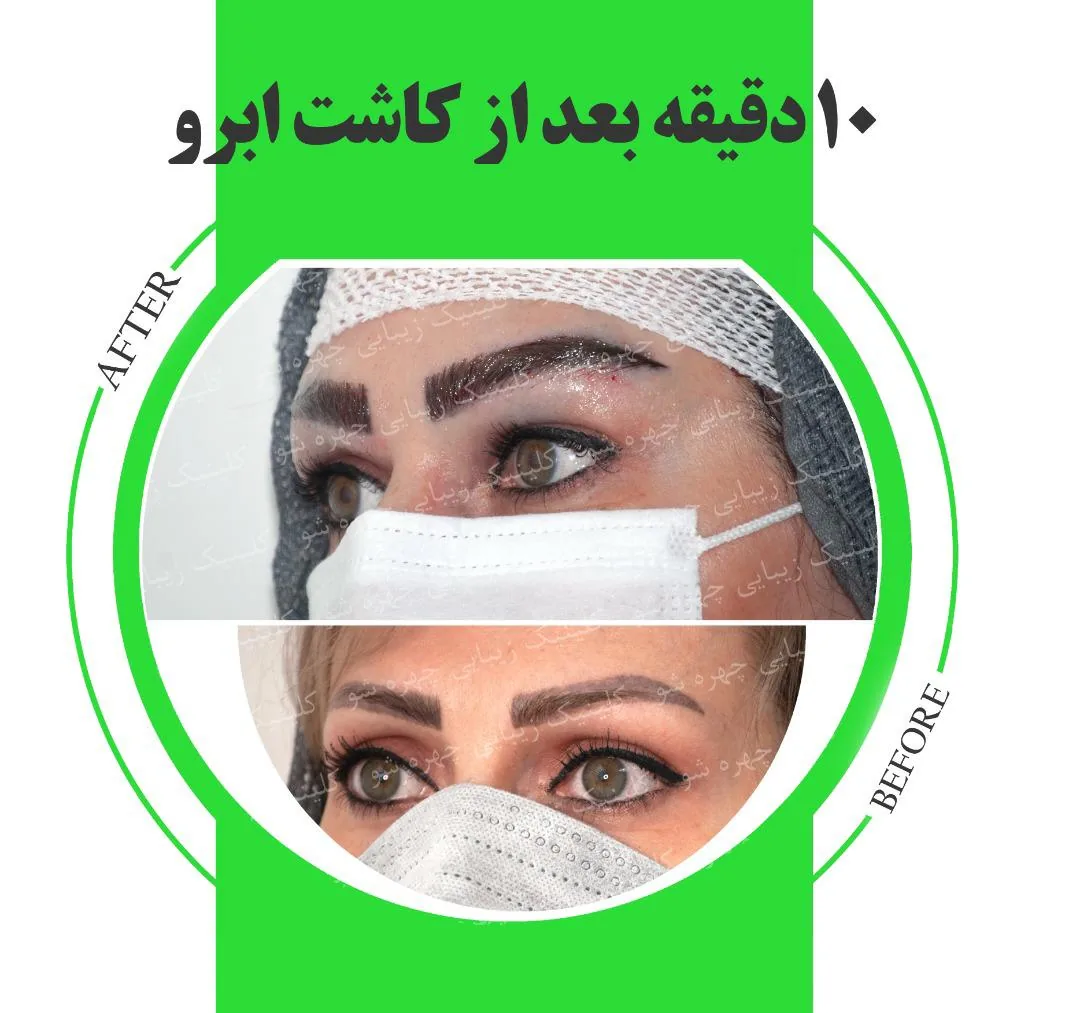 کلینیک زیبایی چهره شو - تصویر 3