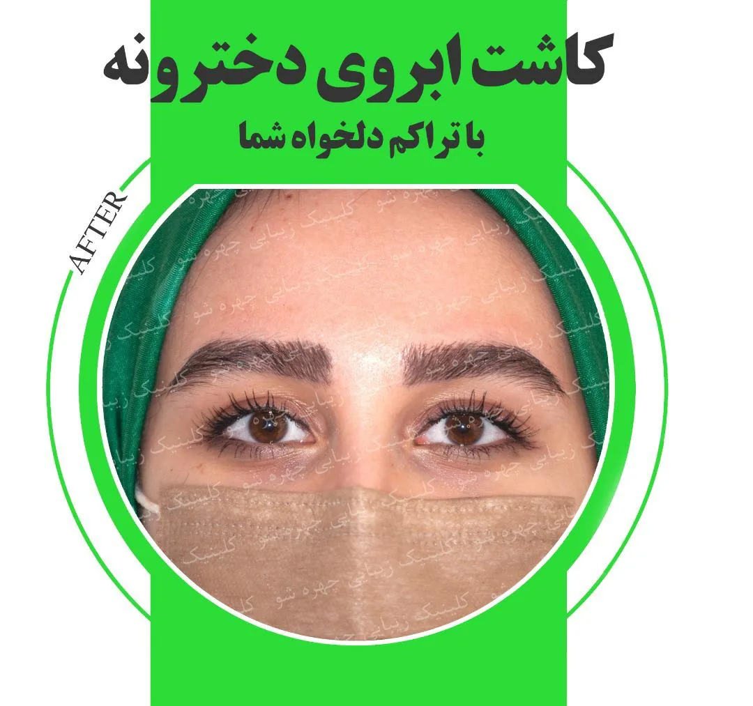 کلینیک زیبایی چهره شو - تصویر 4